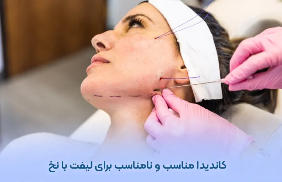 کاندیدا مناسب و نامناسب برای لیفت صورت با نخ