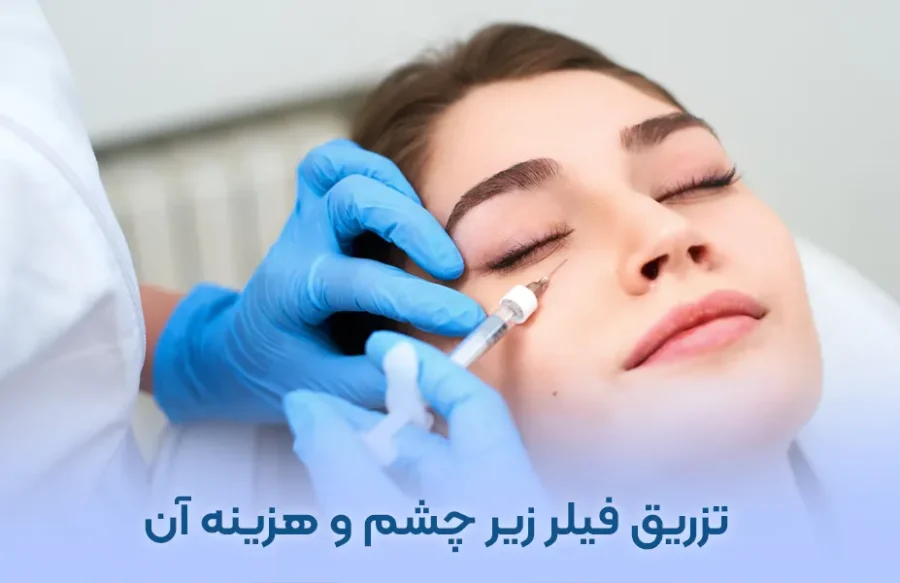 فیلر زیر چشم