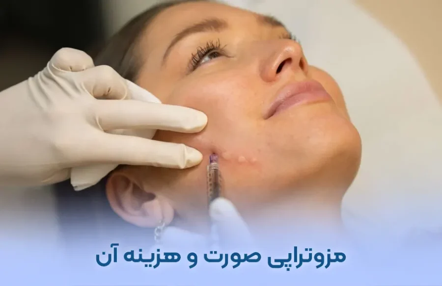 مزوتراپی صورت