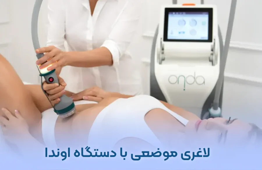 لاغری موضعی با دستگاه اوندا