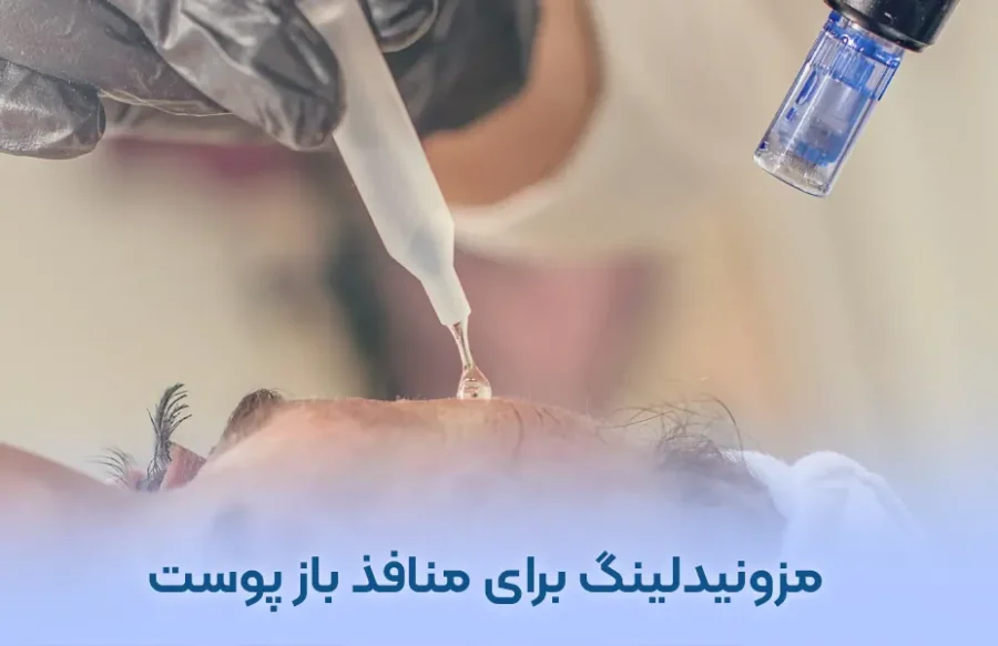 درمان منافذ باز پوست با مزونیدلینگ