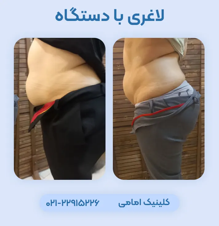 لاغری در کلینیک امامی
