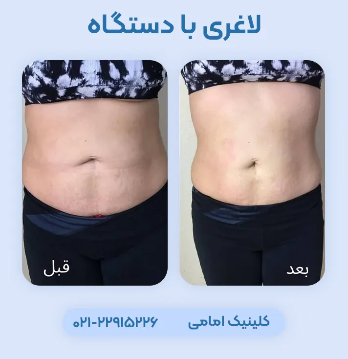 کلینیک لاغری