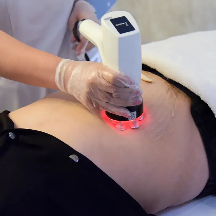 دستگاه لاغری آر اف