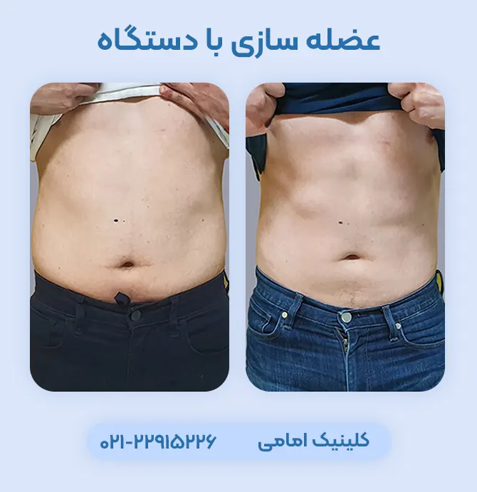 عضله سازی با دستگاه