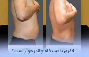 لاغری با دستگاه