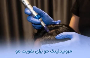 مزونیدلینگ مو