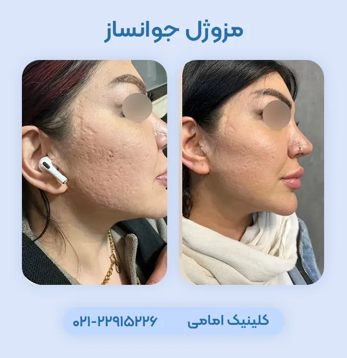 مزوژل های کره ای