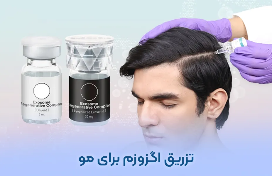 هزینه تزریق اگزوزم برای مو در تهران 1404