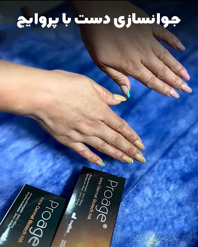 مزوژل پروایج برای دست