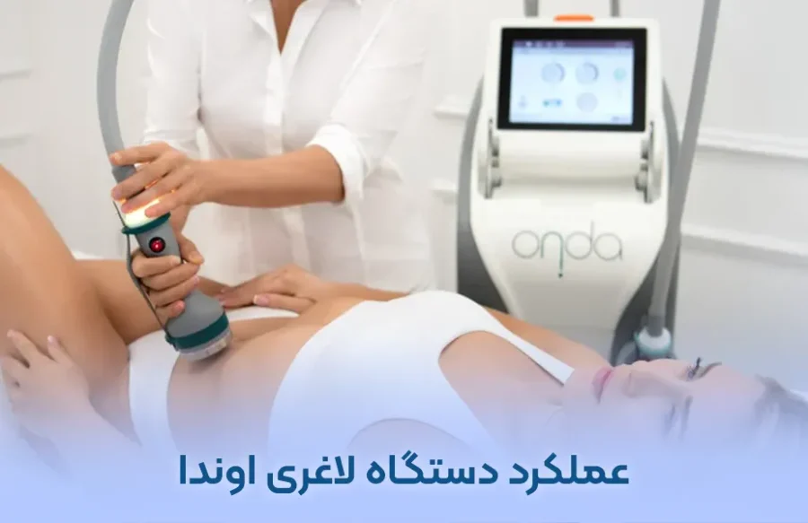 عملکرد دستگاه لاغری اوندا در لاغری شکم