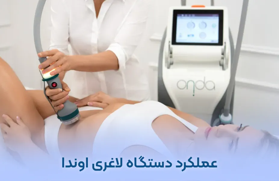 عملکرد دستگاه لاغری اوندا در لاغری شکم