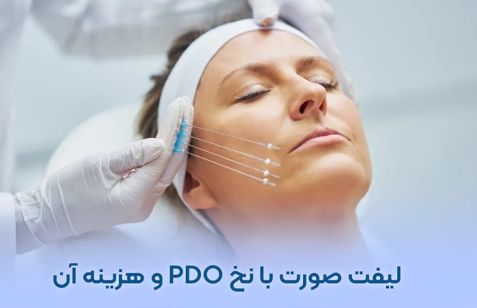لیفت صورت با نخ PDO و مقایسه با دیگر نخ ها