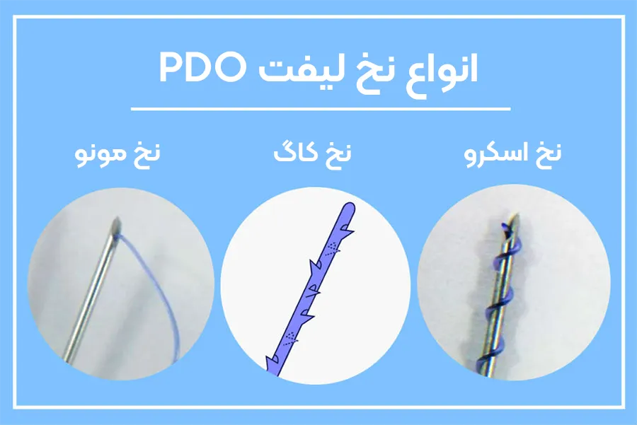 انواع نخ PDO