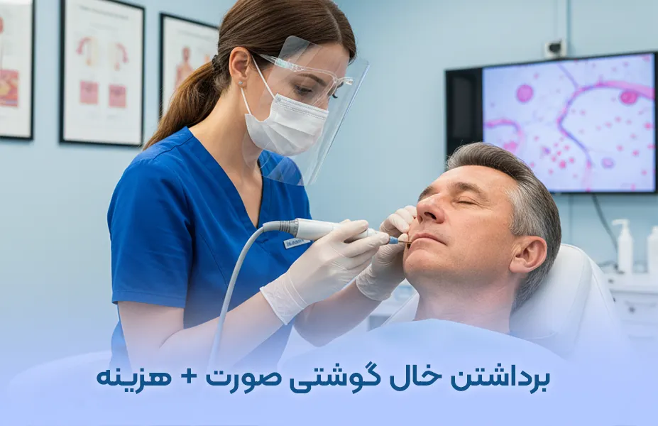 هزینه و عوارض برداشتن خال گوشتی صورت + فیلم و عکس