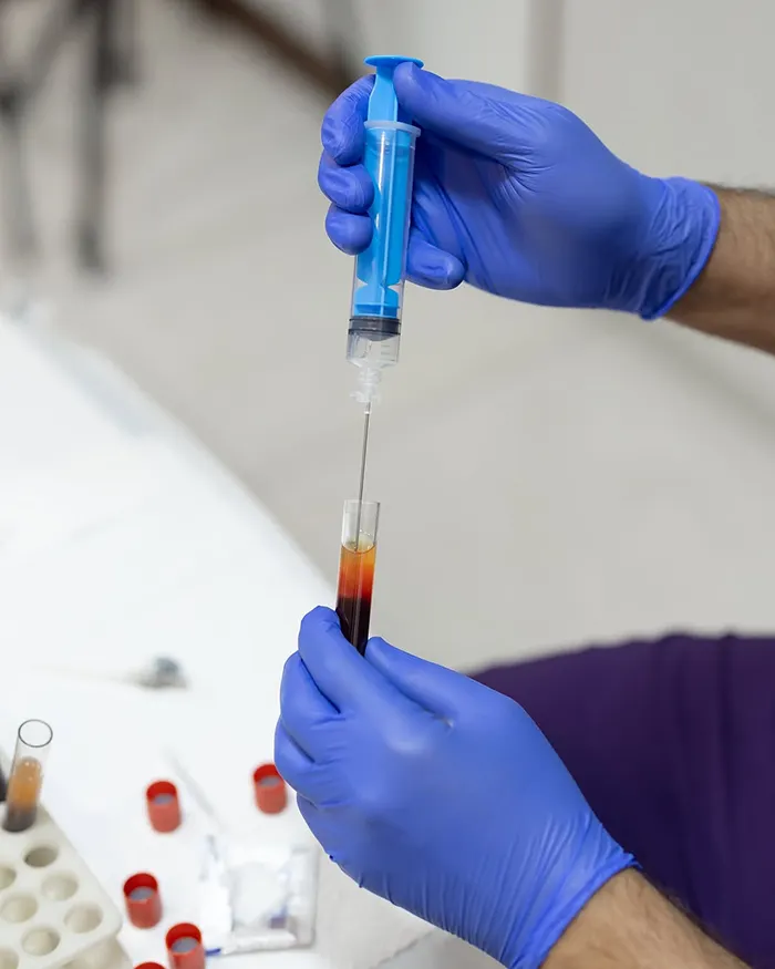 تزریق بایوفیلر