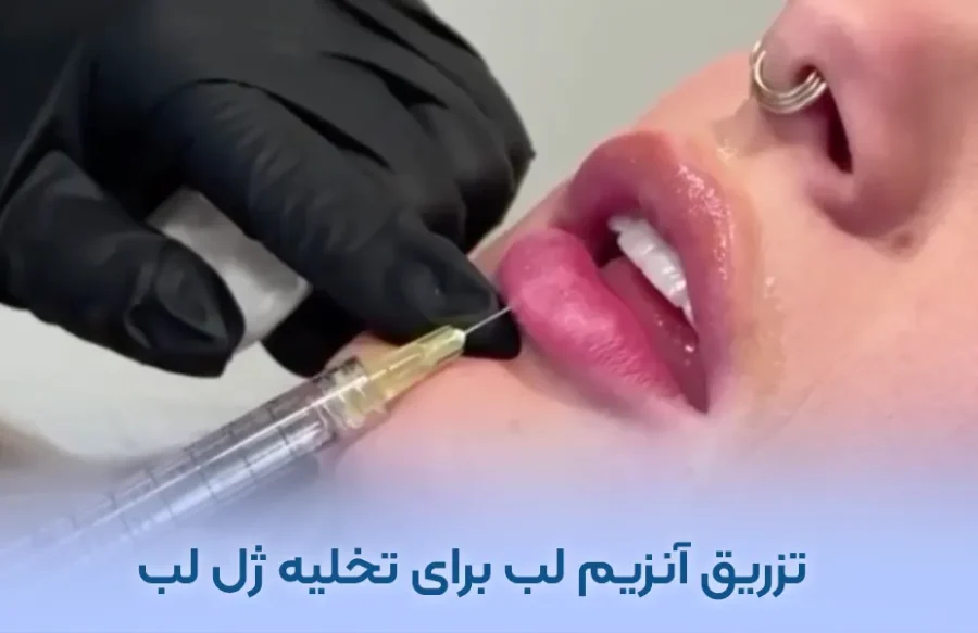 تزریق آنزیم لب برای تخلیه ژل لب