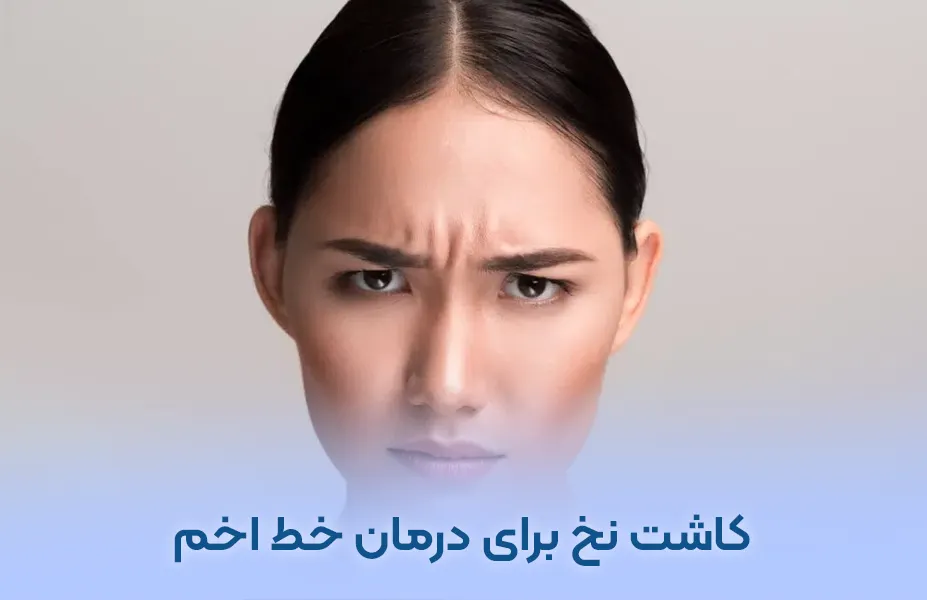 از بین بردن خط اخم با نخ و هزینه آن در تهران