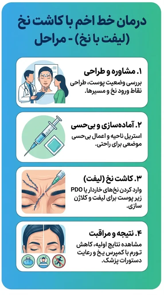 مراحل کاشت نخ برای درمان خط اخم