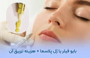 تزریق بایوفیلر صورت