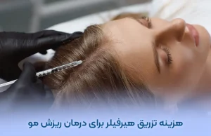 هزینه تزریق هیرفیلر