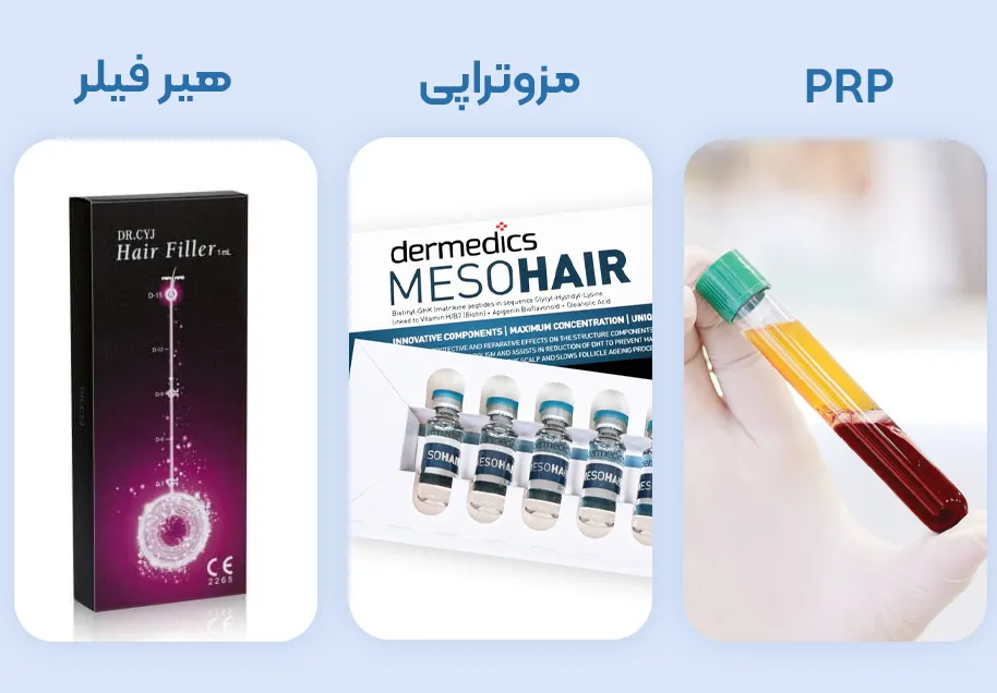 مقایسه هیرفیلر، PRP و مزوتراپی