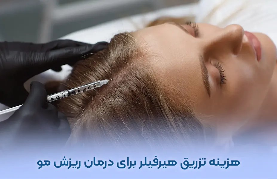 هزینه تزریق هیرفیلر برای درمان ریزش مو در تهران