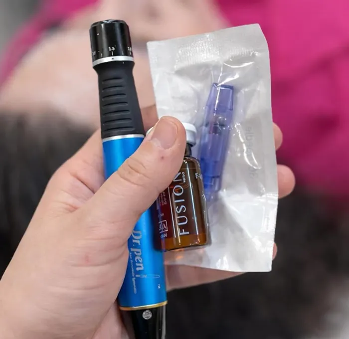 مزوتراپی جای جوش