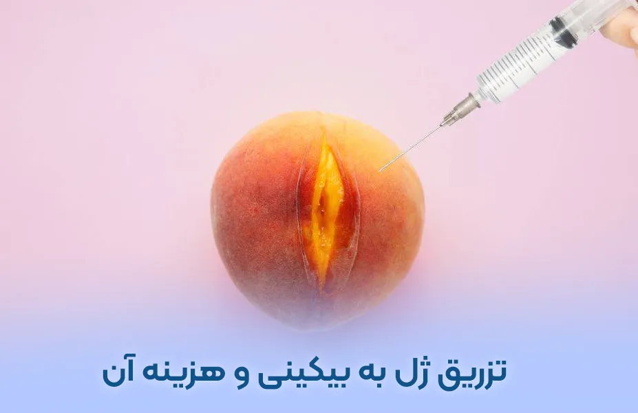 تزریق ژل به بیکینی و هزینه آن + عکس