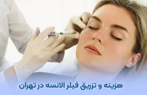 تزریق فیلر الانسه در تهران