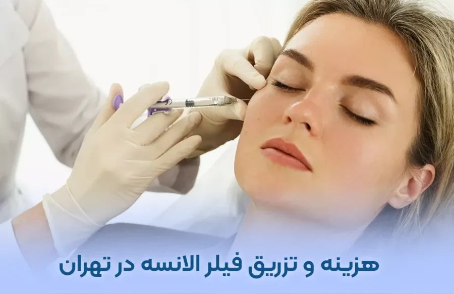 تزریق فیلر الانسه در تهران