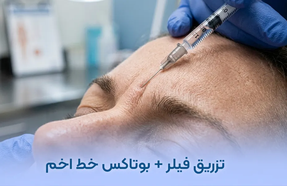 درمان خط اخم با تزریق فیلر و بوتاکس + هزینه توسط دکتر امامی