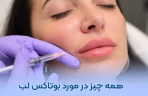بوتاکس لب