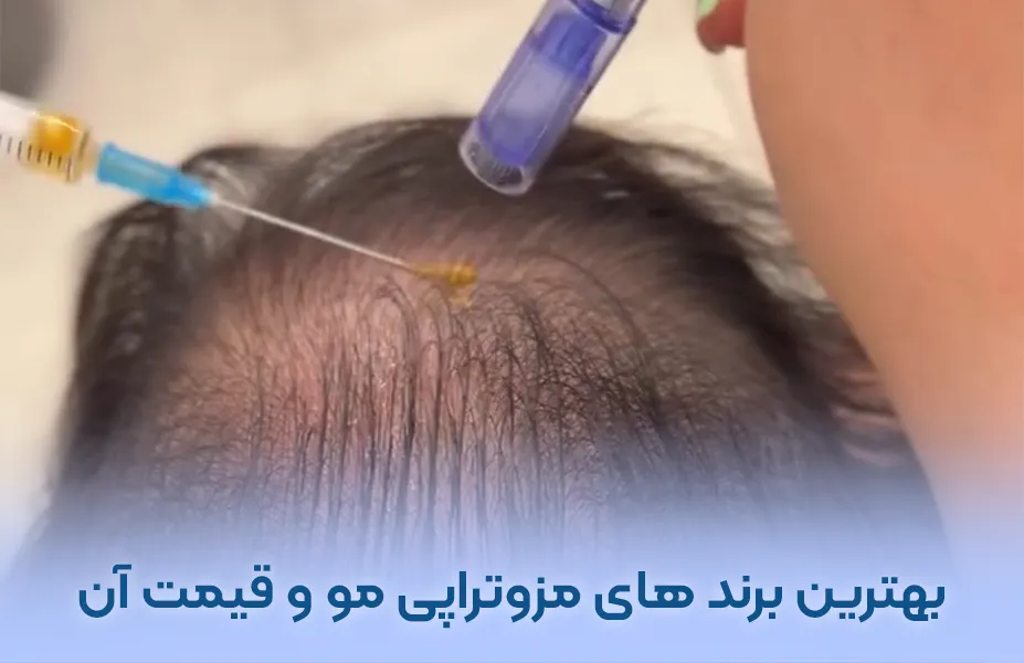 برند های معروف مزوتراپی مو در بازار ایران + قیمت