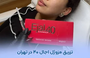 مزوژل اجال ۴۰