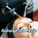 مزایا و معایب مزونیدلینگ