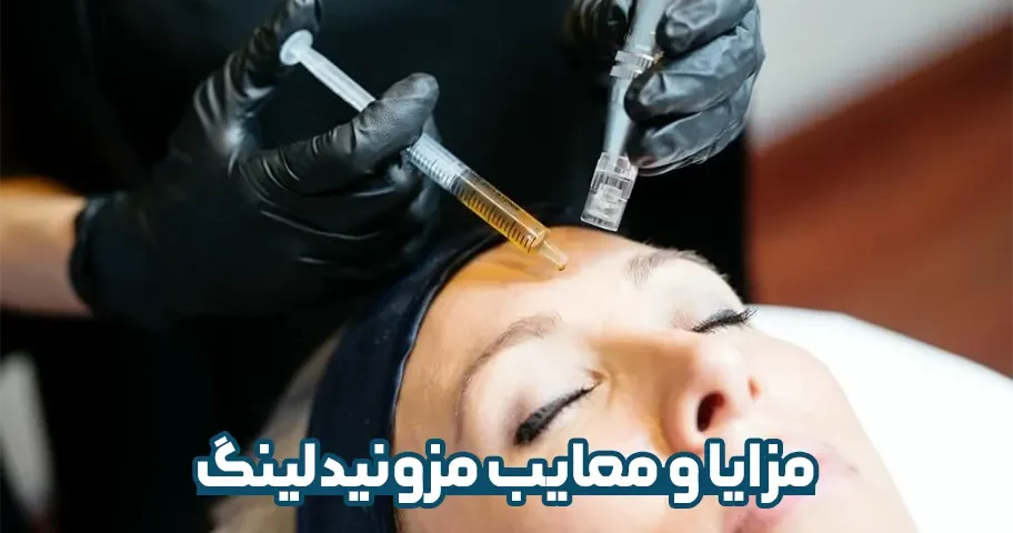 مزایا و معایب مزونیدلینگ