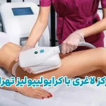 مرکز لاغری کرایولیپولیز در تهران