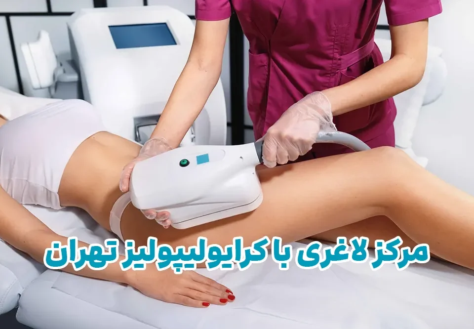 مرکز لاغری کرایولیپولیز در تهران