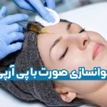 جوانسازی صورت با پی آرپی
