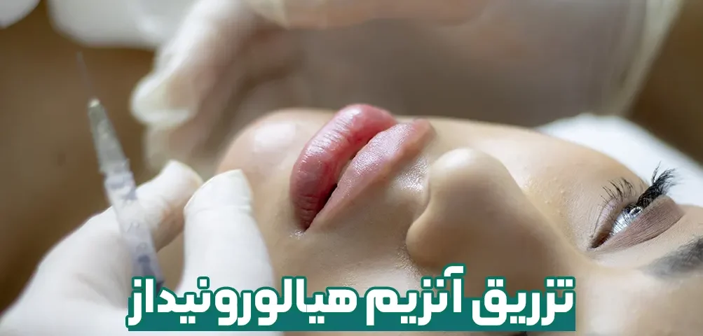 آنزیم هیالورونیداز