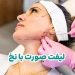 لیفت صورت با نخ