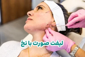 لیفت صورت با نخ