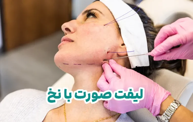 لیفت صورت با نخ