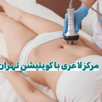 مرکز لاغری کویتیشن تهران