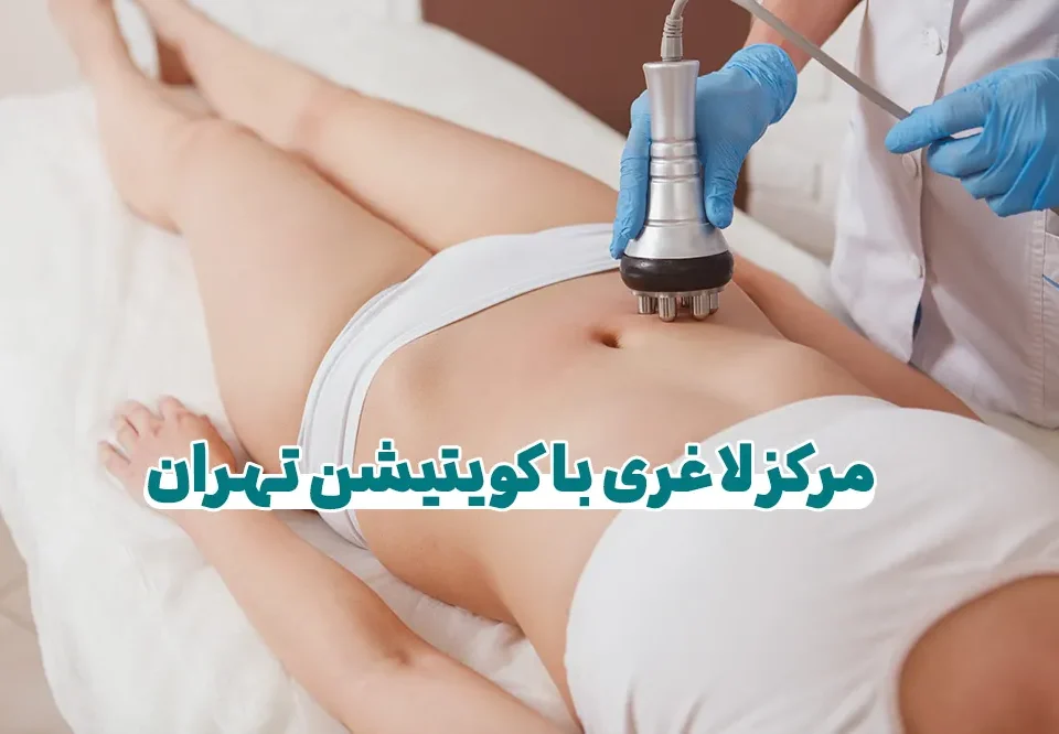 مرکز لاغری کویتیشن تهران