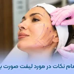 لیفت صورت با نخ