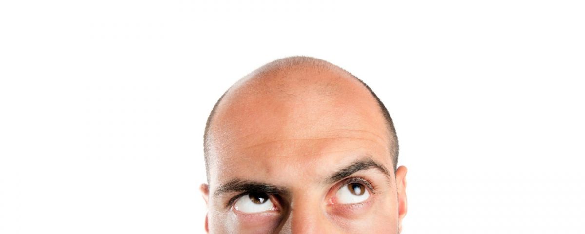 دلیل ریزش مو