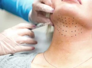 مزو چربی سوز غبغب