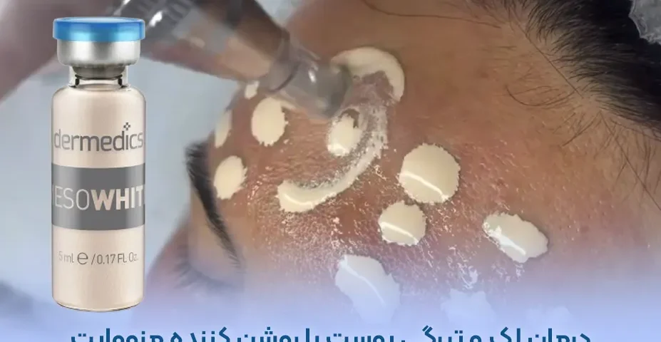 درمان لک و تیرگی پوست با مزووایت